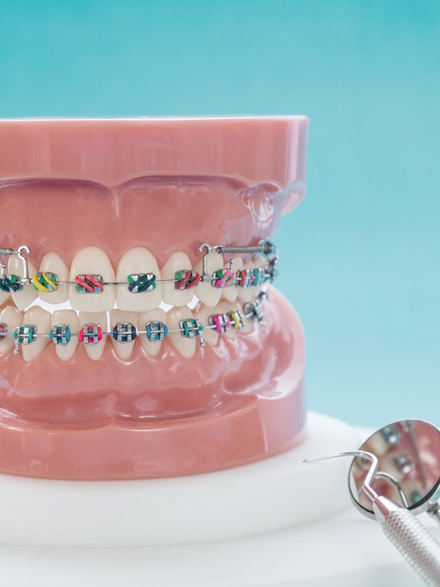 Implantes, prótesis fija y removible, ortodoncia...