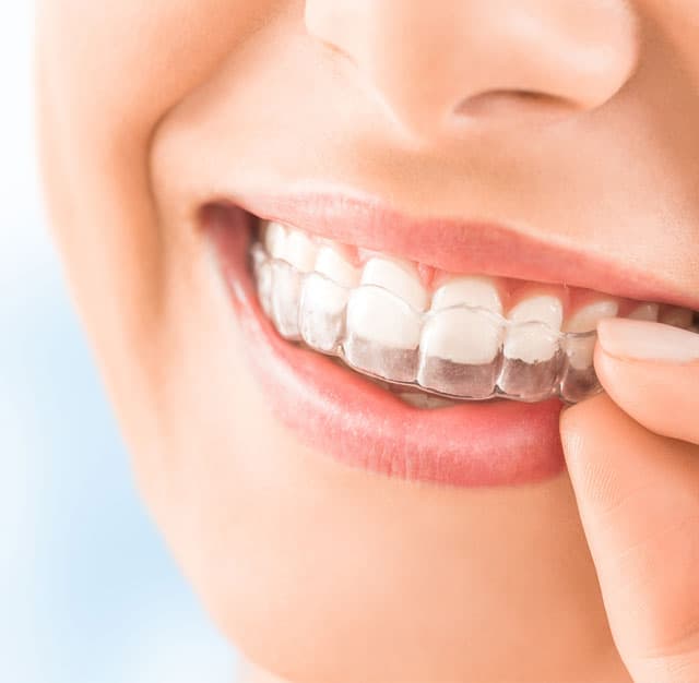 Alinea tu sonrisa con nuestra ortodoncia en Vigo