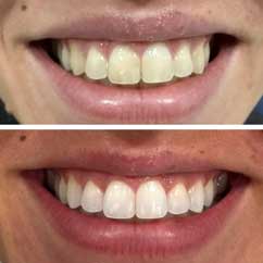 Clínica dental en Vigo