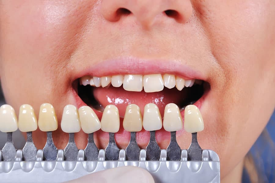 Damos respuesta a tus dudas sobre odontología estética