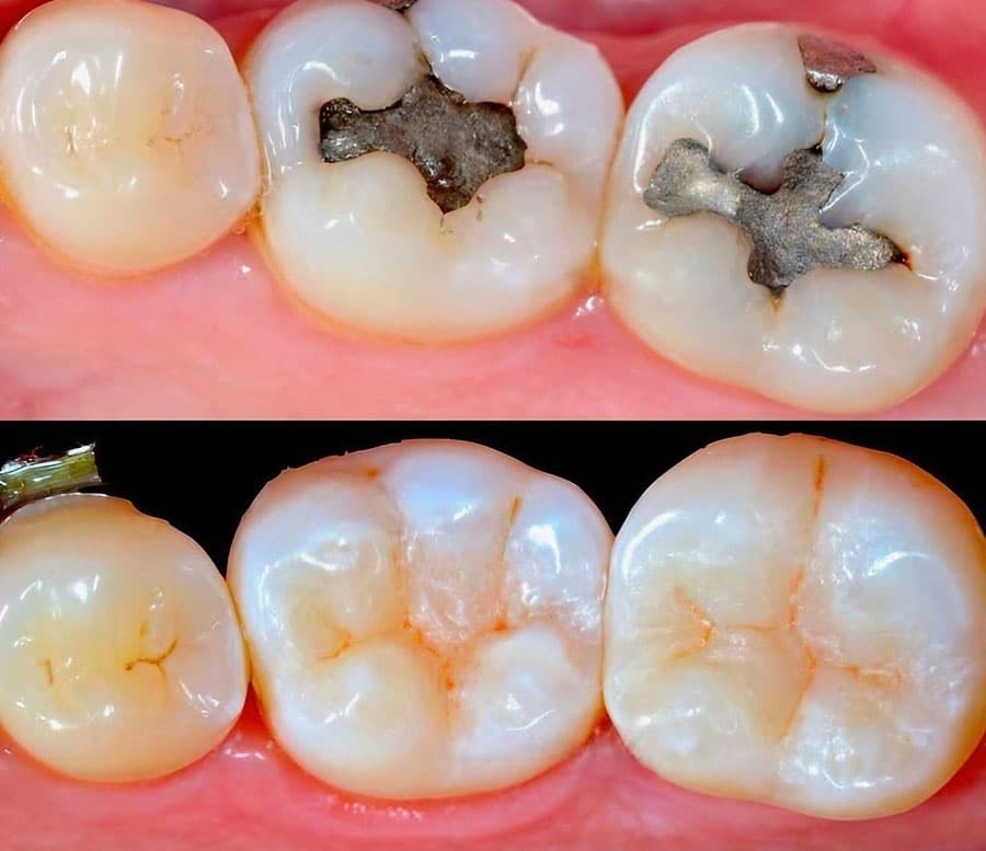 Especialistas en operatoria dental