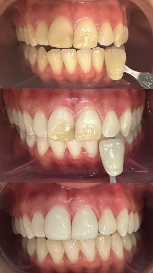 Odontología estética - Dent & Dent