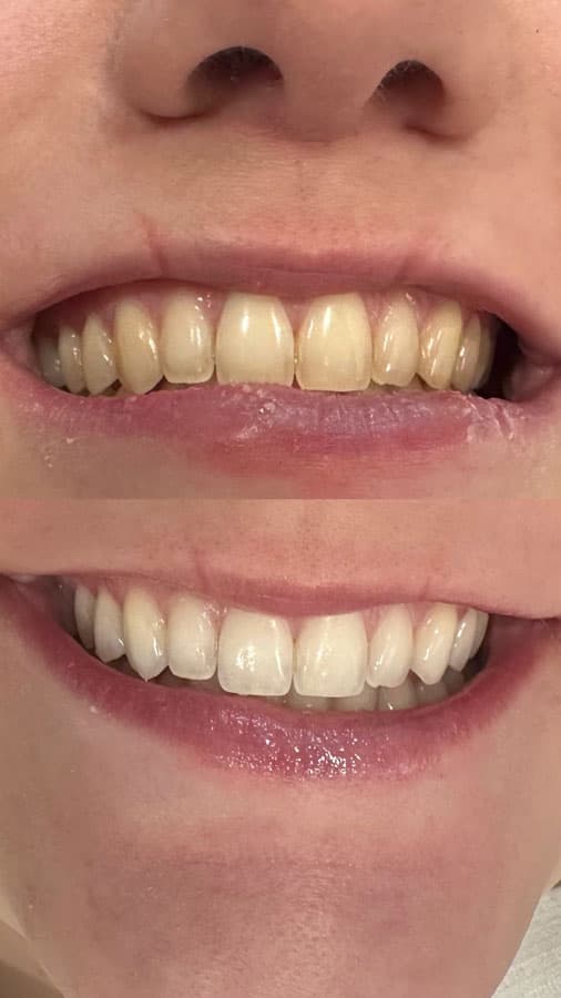 Odontología estética - Dent & Dent