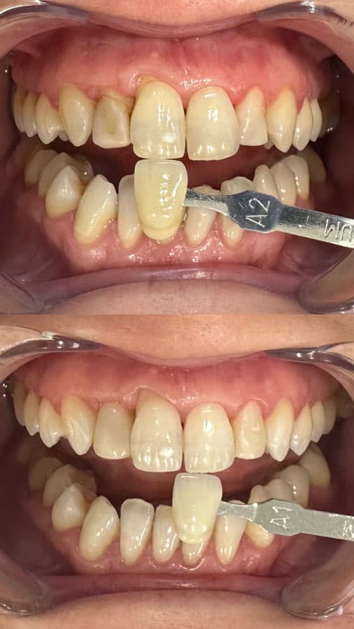 Odontología estética - Dent & Dent