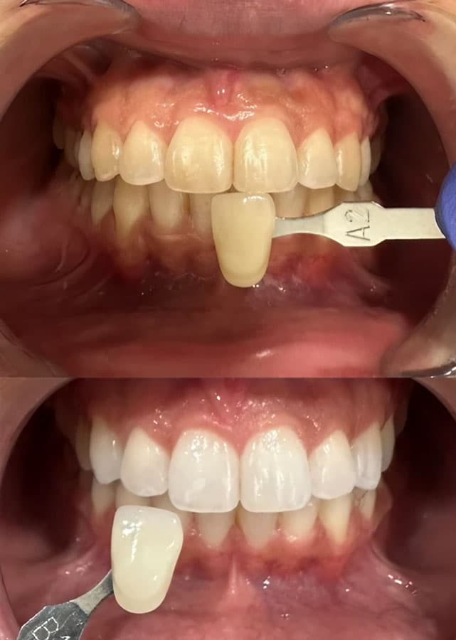 Odontología estética - Dent & Dent