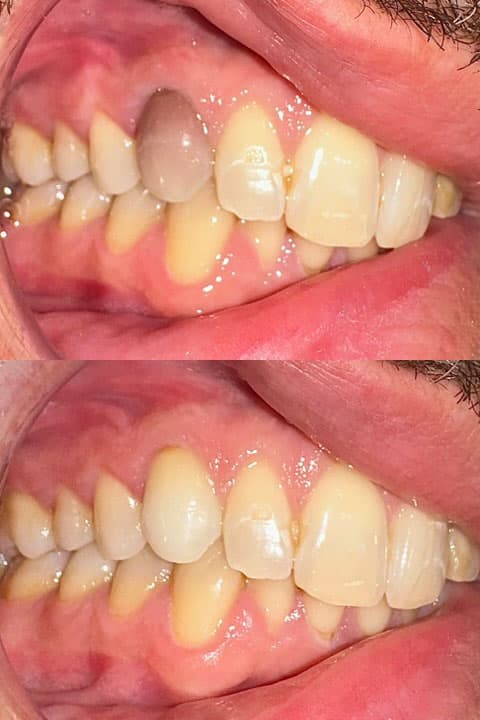 Odontología estética - Dent & Dent