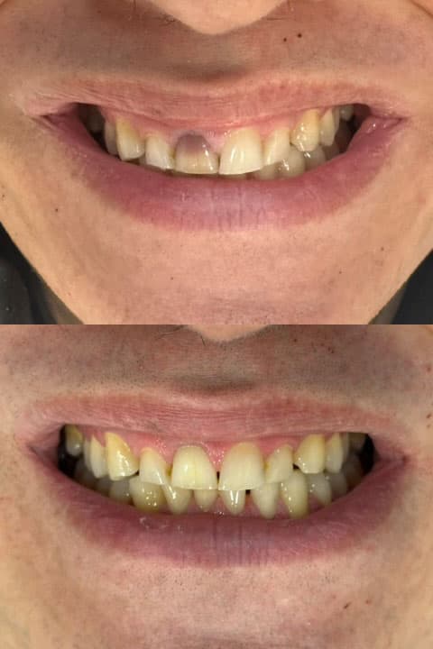 Odontología estética - Dent & Dent