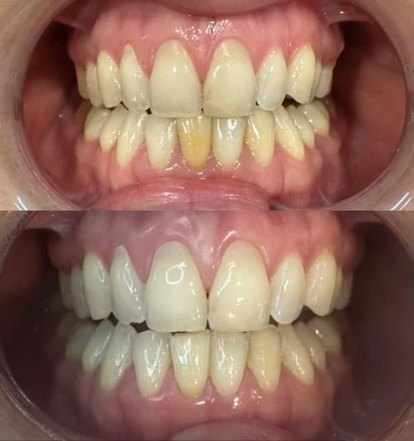 Odontología estética - Dent & Dent