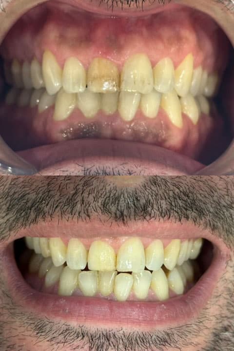 Odontología estética - Dent & Dent