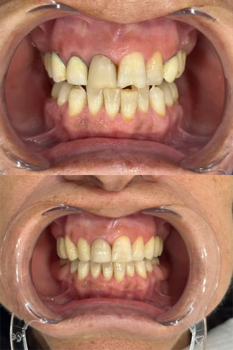 Odontología estética - Dent & Dent