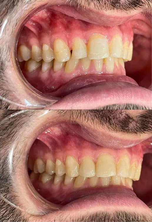 Odontología estética - Dent & Dent