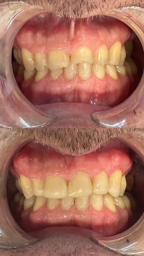 Odontología estética - Dent & Dent