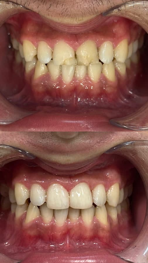 Odontología estética - Dent & Dent