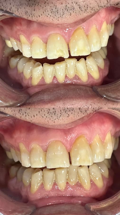 Odontología estética - Dent & Dent