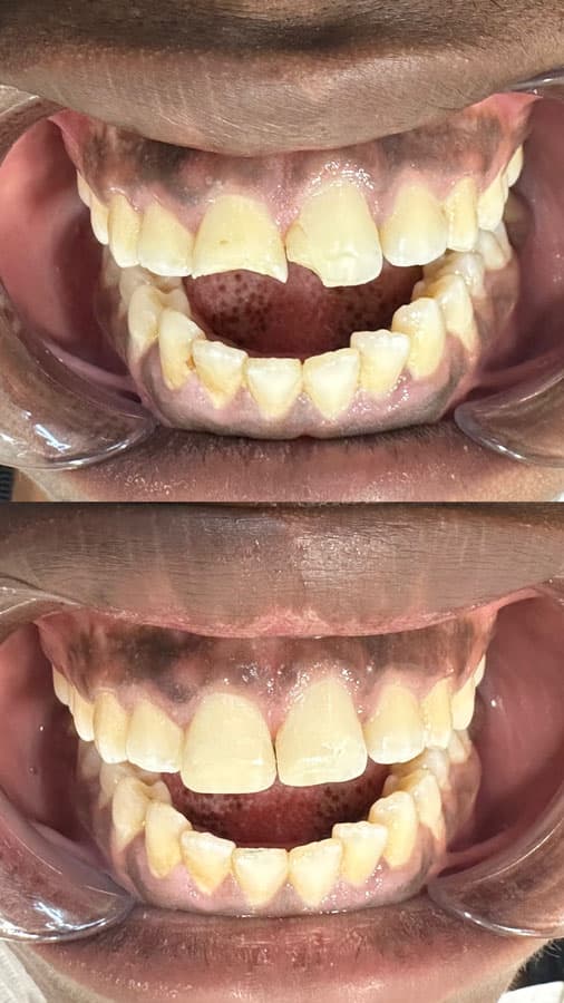Odontología estética - Dent & Dent