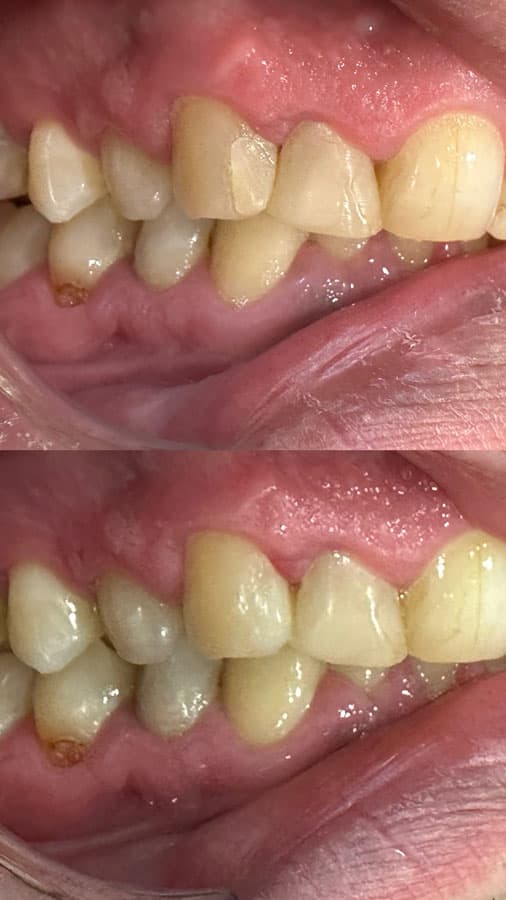 Odontología estética - Dent & Dent
