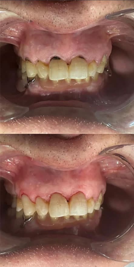 Odontología estética - Dent & Dent