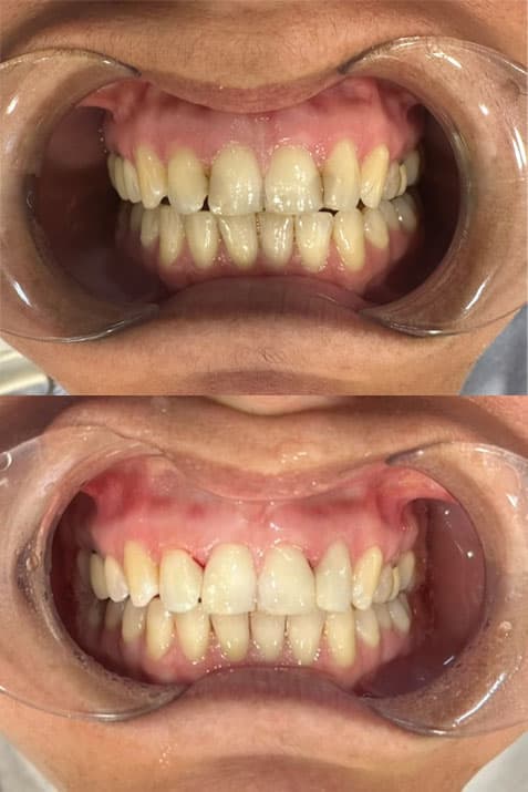 Odontología estética - Dent & Dent