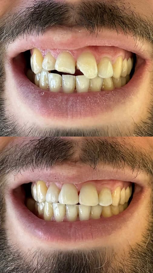 Odontología estética - Dent & Dent