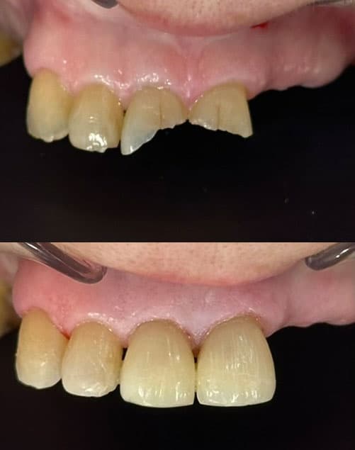 Odontología estética - Dent & Dent