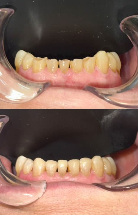 Odontología estética - Dent & Dent