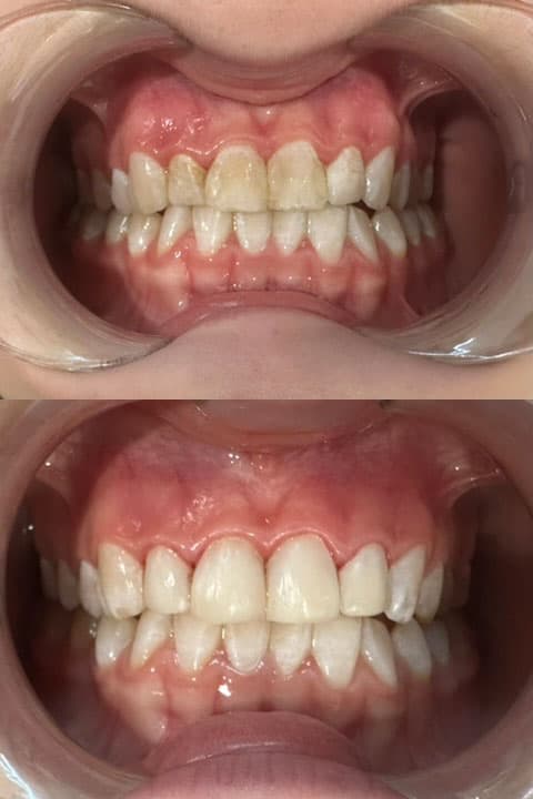 Odontología estética - Dent & Dent