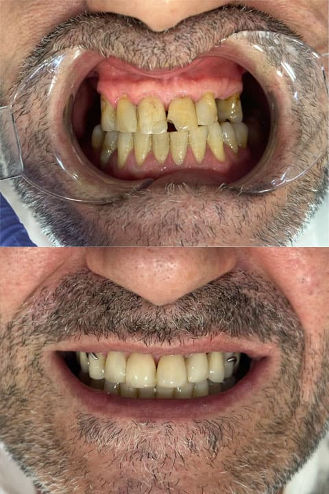 Odontología estética - Dent & Dent