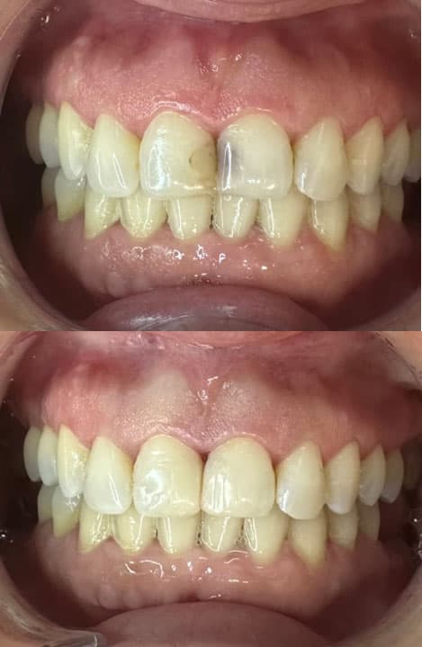 Odontología estética - Dent & Dent