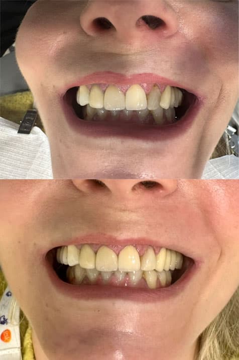 Odontología estética - Dent & Dent