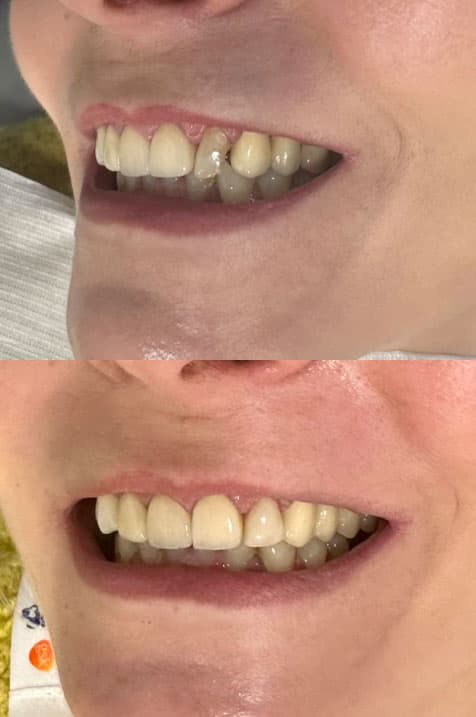 Odontología estética - Dent & Dent