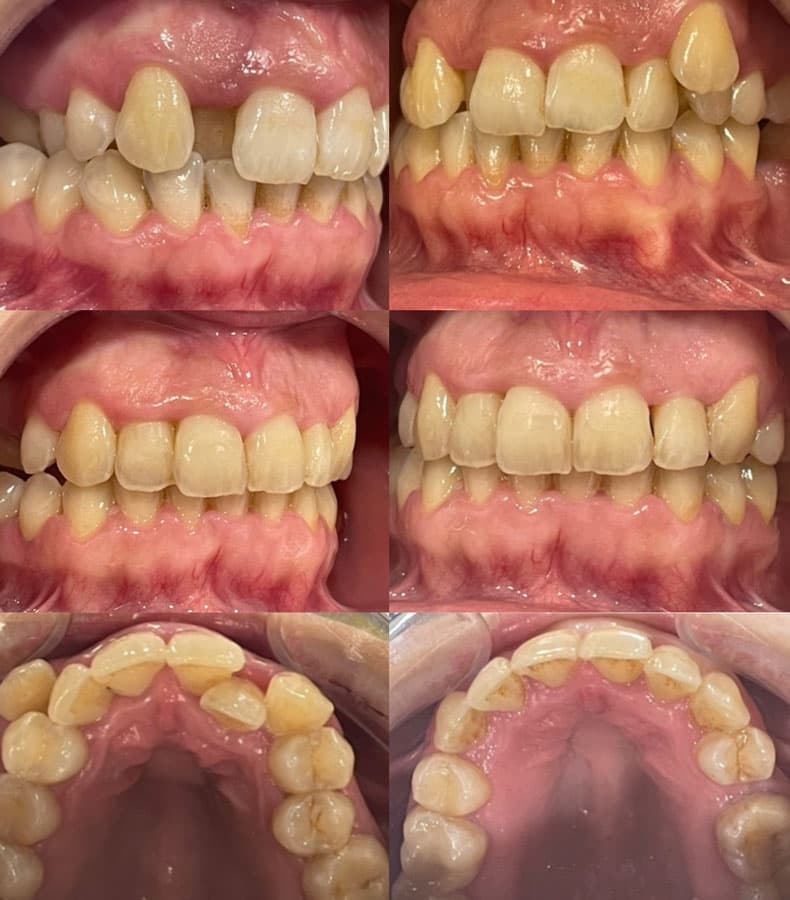 Ortodoncia - Dent & Dent