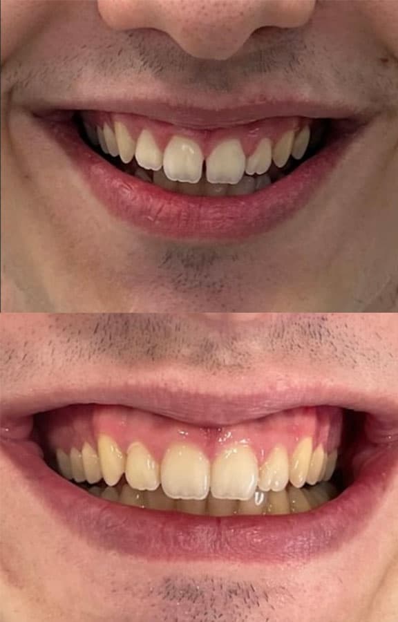 Ortodoncia - Dent & Dent