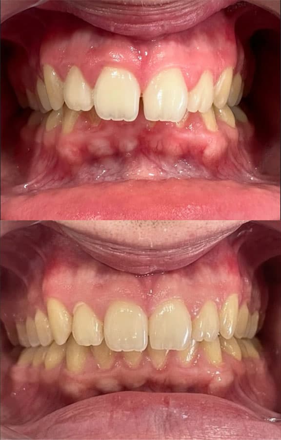 Ortodoncia - Dent & Dent