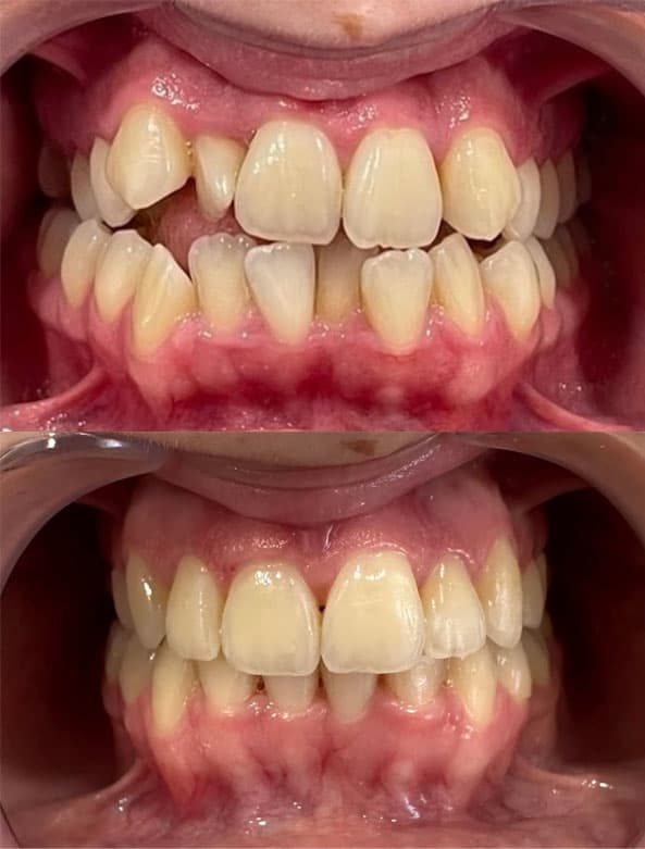 Ortodoncia - Dent & Dent