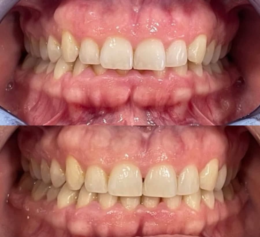 Ortodoncia - Dent & Dent