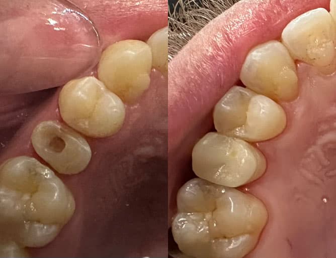 Prótesis - Dent & Dent