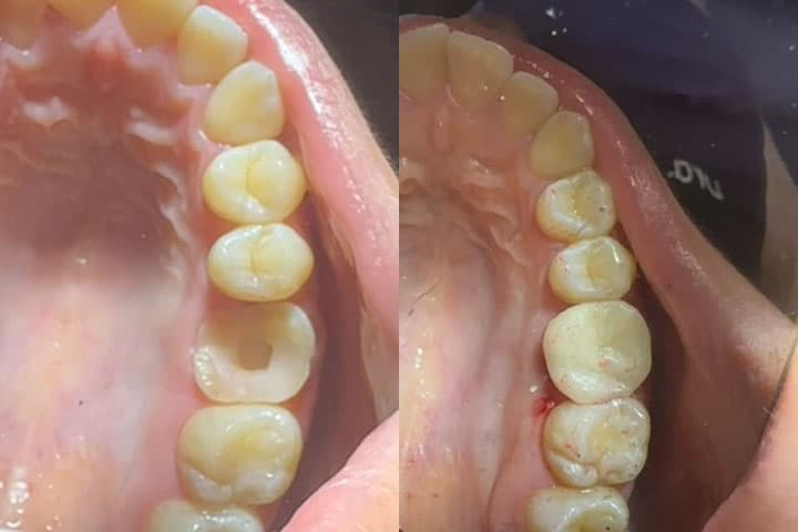 Prótesis - Dent & Dent