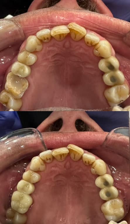 Prótesis - Dent & Dent