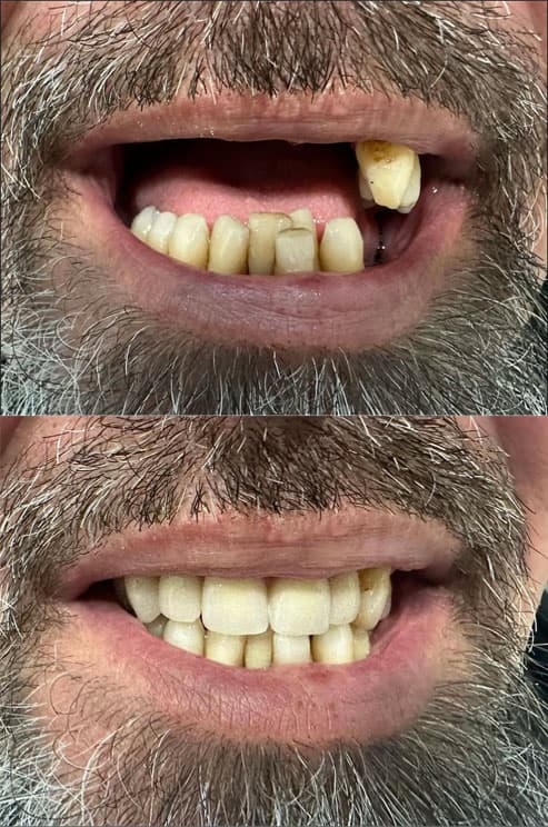 Prótesis - Dent & Dent