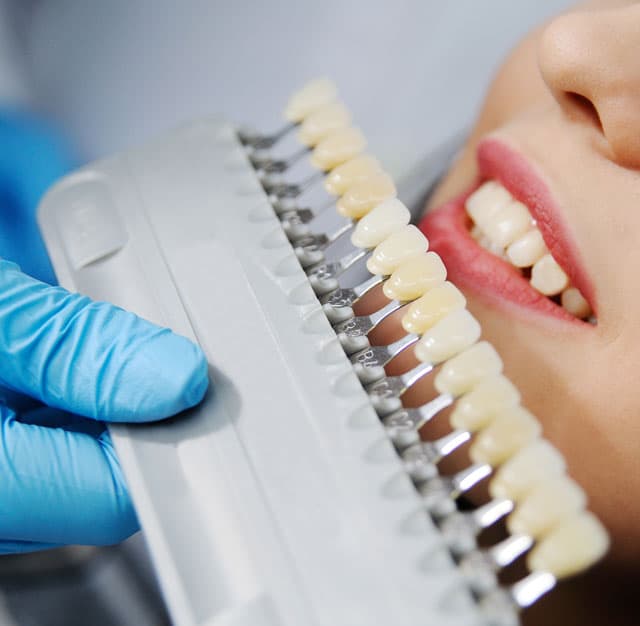 Sonrisas perfectas con odontología estética en Vigo