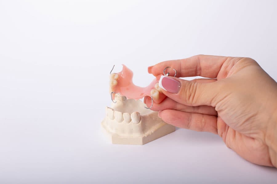 Todo lo que debes saber sobre nuestras prótesis dentales